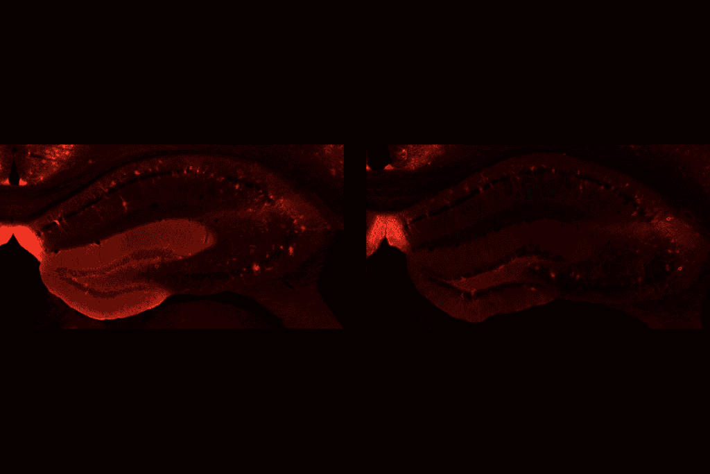 Research image of perineuronal nets.