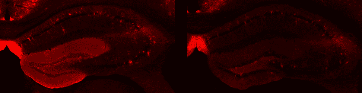 Research image of perineuronal nets.