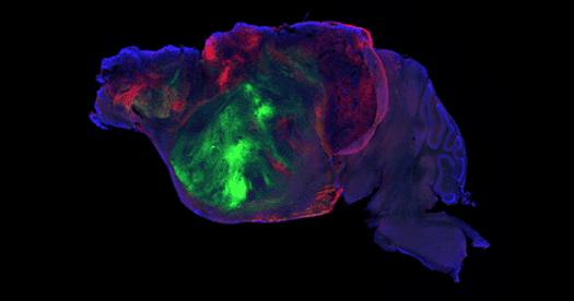 Human Brain Organoids Successfully Grown and Integrated in Mouse Cortex