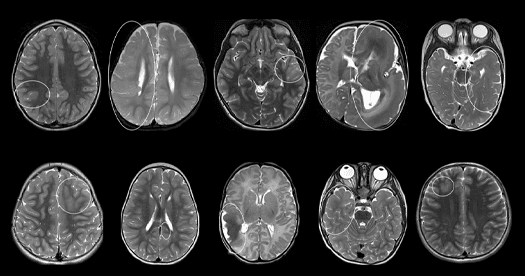 Imagen ilustrativa: Diagnósticos de autismo: ¿cambian las formas de diagnosticar? — Investigación