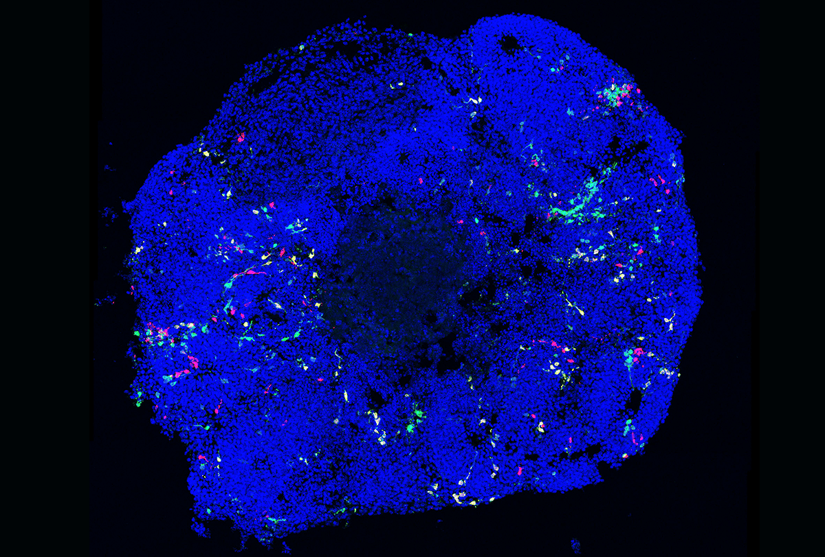 Mouse cortical organoid.