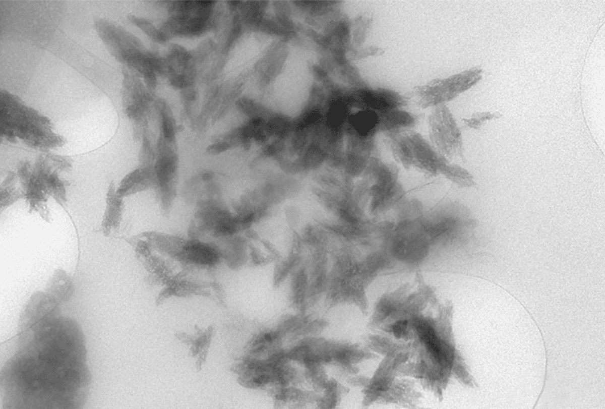 Research image of plastic in the brain.