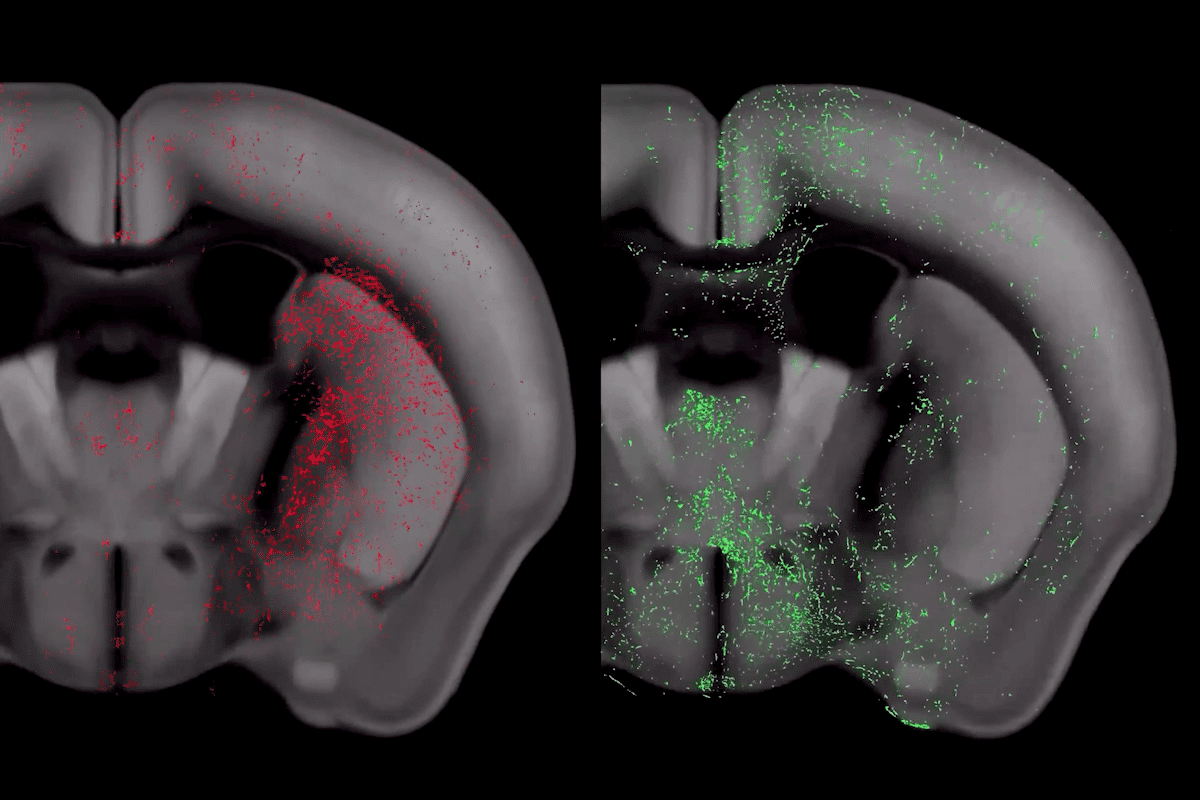 Stanford study reveals first whole-brain serotonin map in mice
