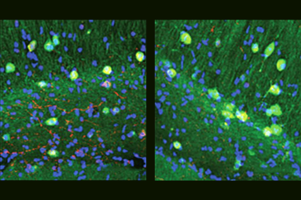 Protein asparagine synthetase in hippocampus neurons.