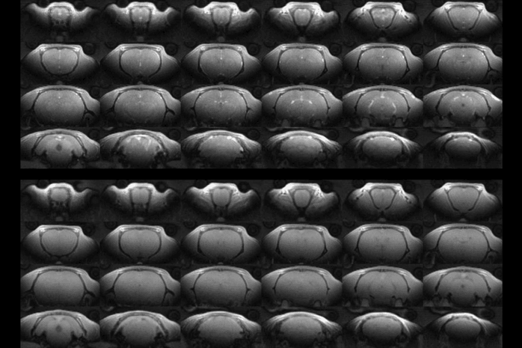 Research image showing a grid of MRI images.