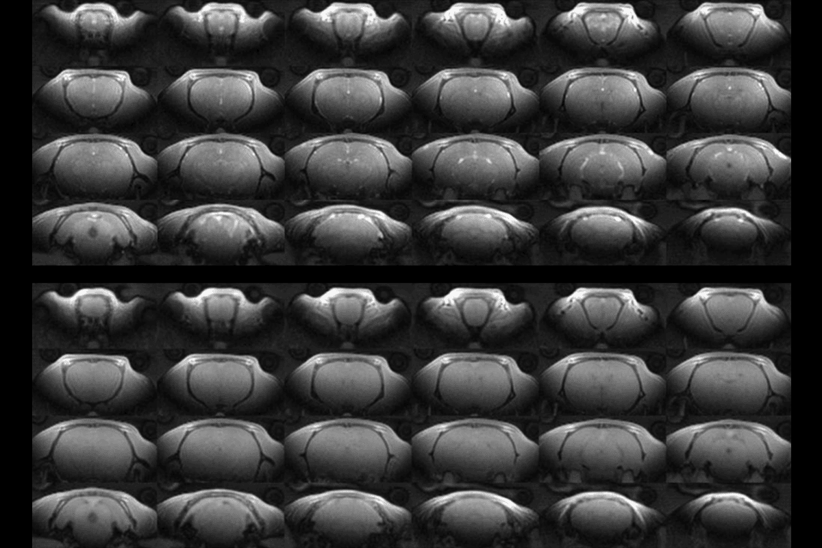 Research image showing a grid of MRI images.