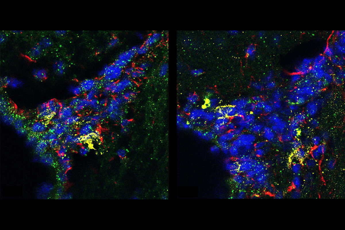 Research image of Mboat2 mRNA quantification.
