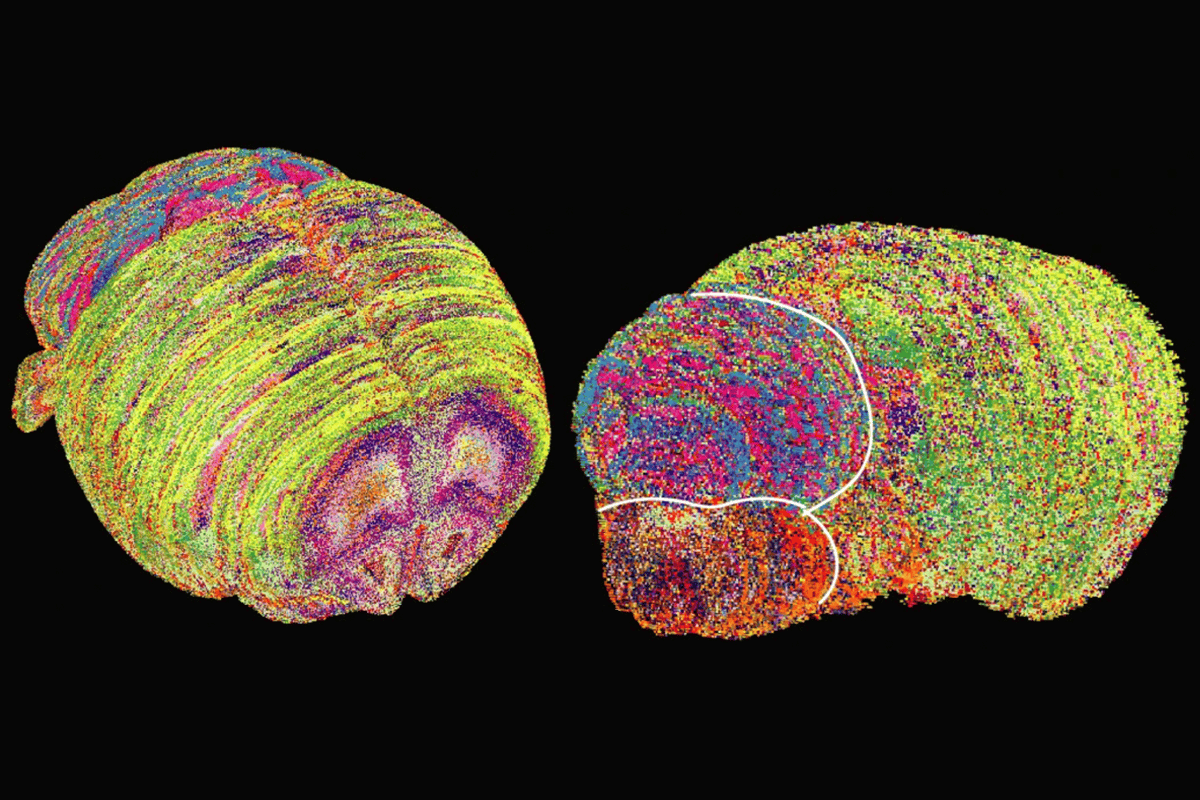 Research image of whole-brain 3D visualizations of pixels colored by their corresponding lipizone.