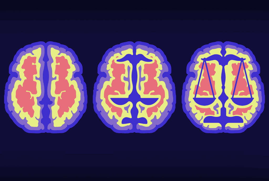 Illustration of pixellated MRI scans morphing into the scales of justice.