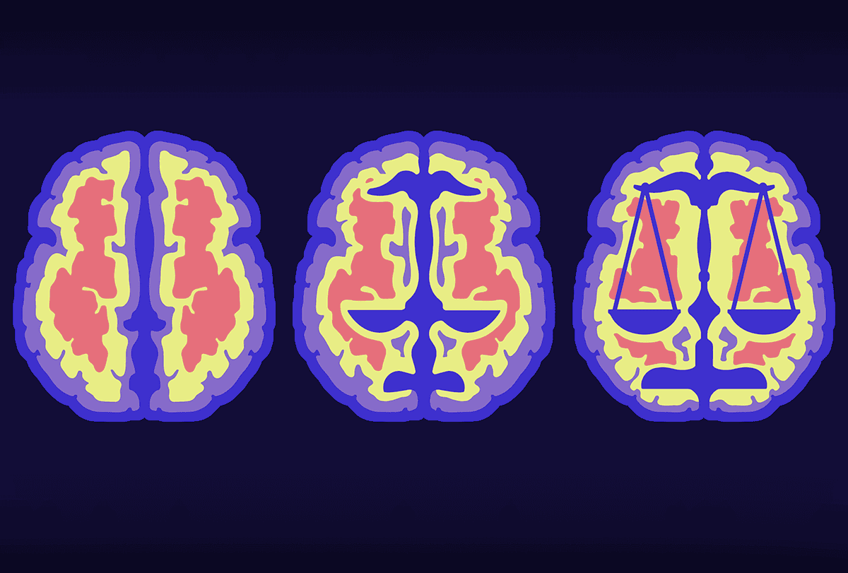 Illustration of pixellated MRI scans morphing into the scales of justice.