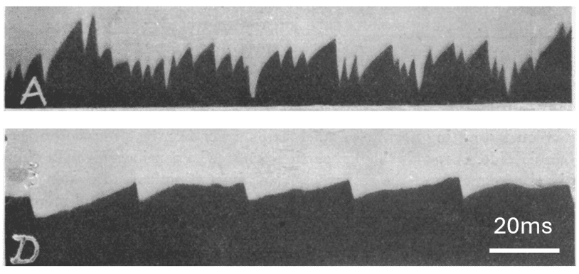 The first spontaneous spikes, recorded using a capillary electrometer.
