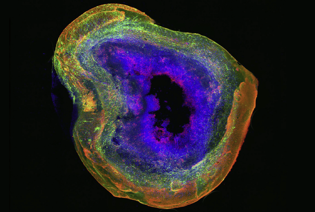 Research image of an organoid with a necrotic core.