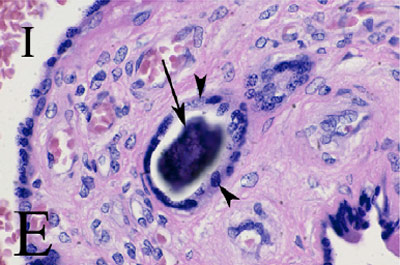 Research image of abnormal cells in the placenta.