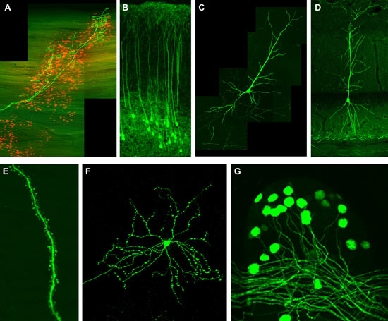 Neurons glowing with green fluorescent protein
